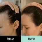 Sistema di microinfusione multi-peptidica  e adenosina per la caduta dei capelli