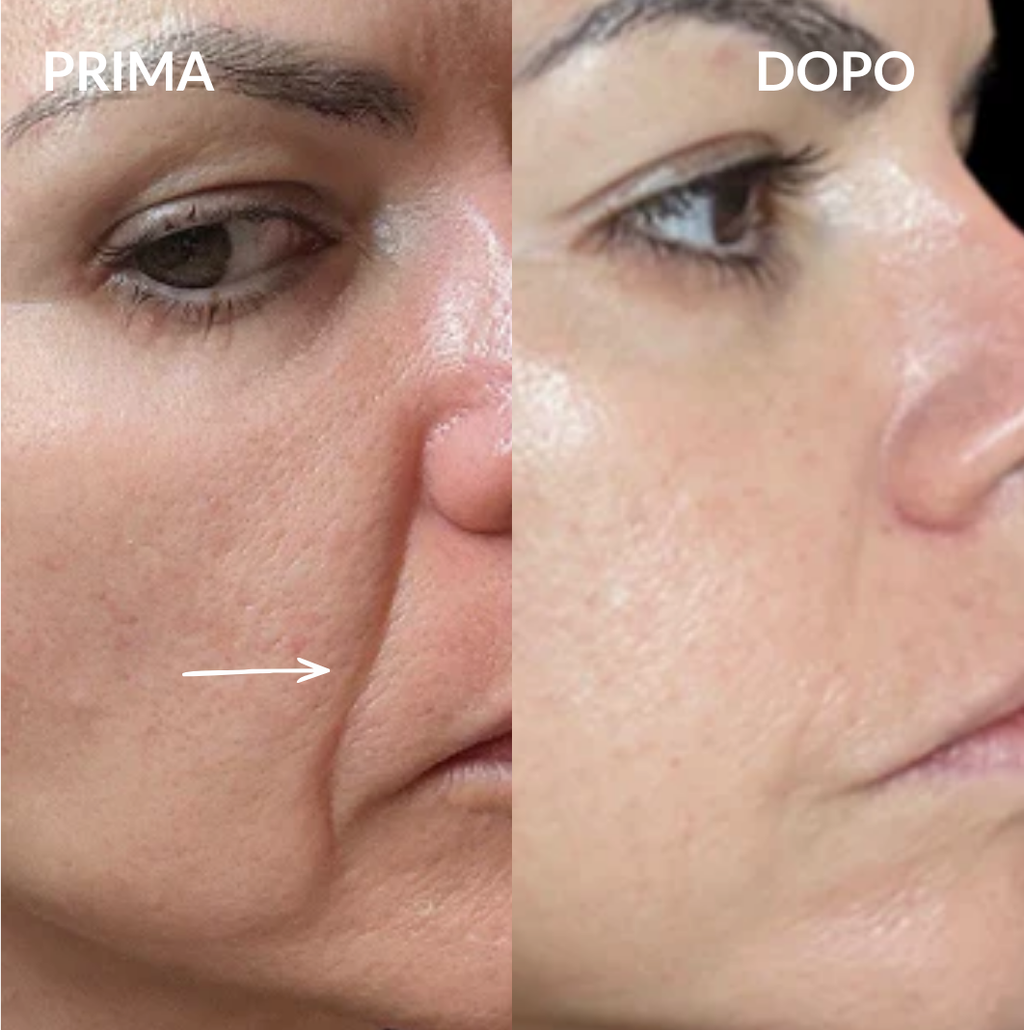 Crema Anti-Età al Calcio e Collagene